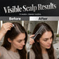 🌿 Apply & Massage in One Step – Scalp Treatment Comb for Hair Growth Serums & Oils. 50% Off Today. Free Returns