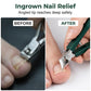 🦶 Tame Ingrown Toenails at Home – Slanted Clipper Set, Precise & Safe. 50% Off. UK Stock