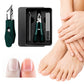 🦶 Tame Ingrown Toenails at Home – Slanted Clipper Set, Precise & Safe. 50% Off. UK Stock